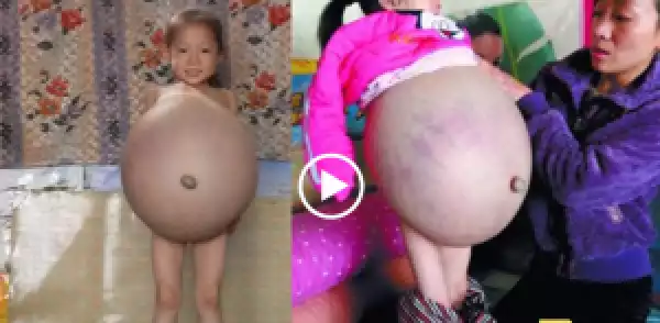 Four Year Old Girl Pregnant in China… Wonders Shall Never End.